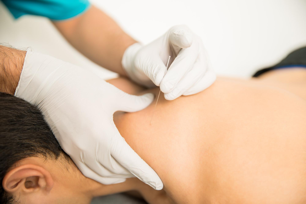 How Is Dry Needling Massage Different from Trigger Point Therapy? 1 Dry needling massage